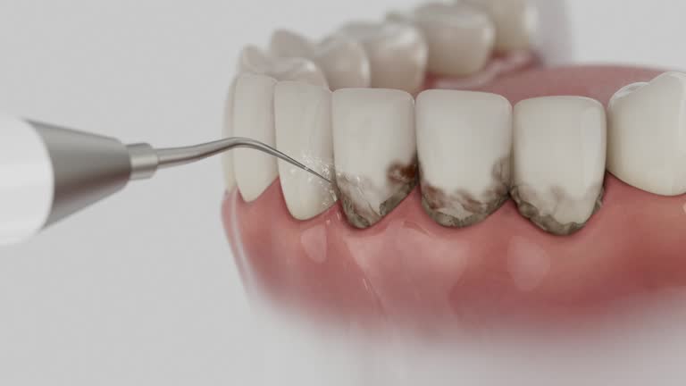 Trusted Tooth Extraction service in Potomac Park, CA - Dentist Open Now